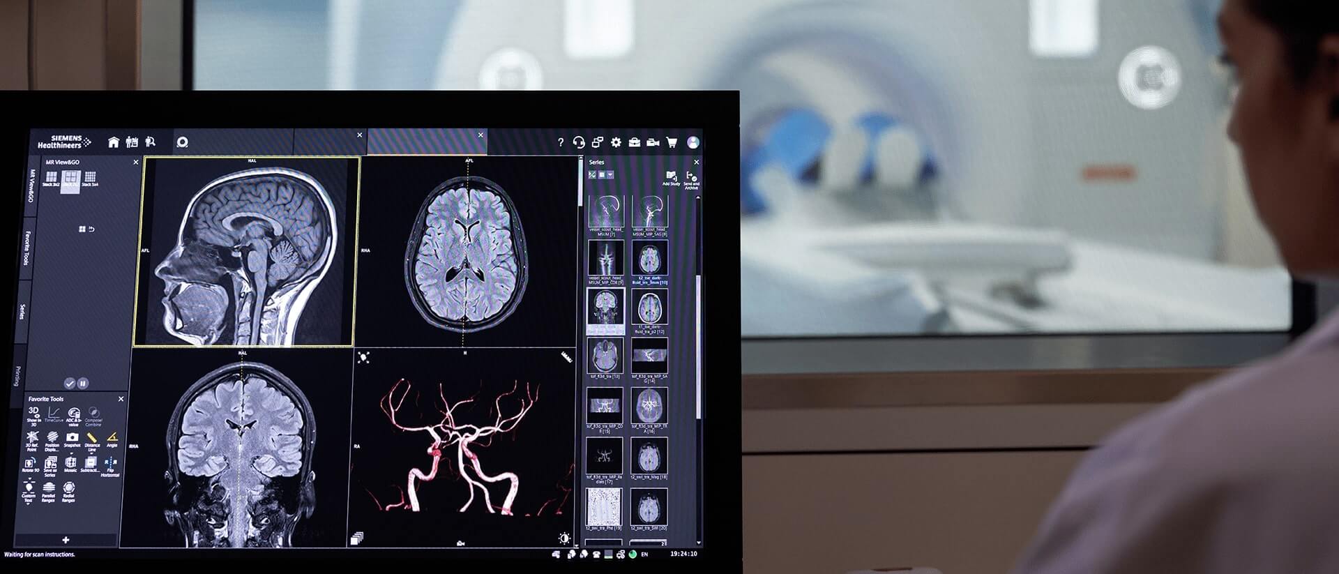 médico a analisar radiografias do sistema nervoso central num monitor
