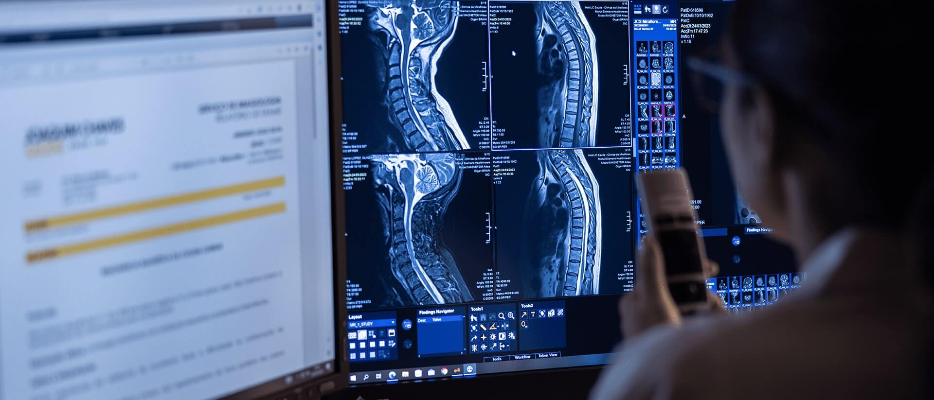 Monitors with images of the central nervous system 
