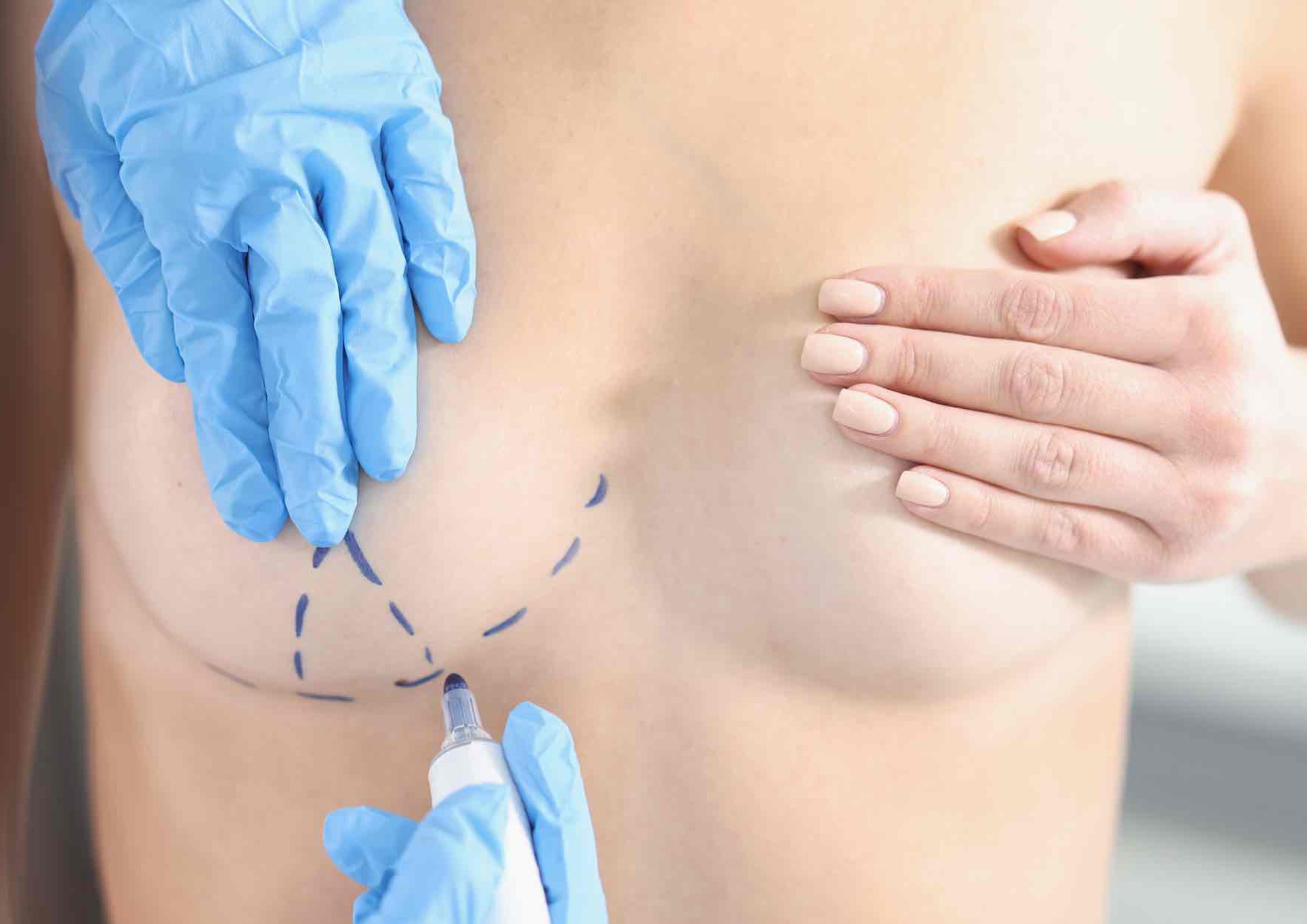 Pall Mall Fallback Image