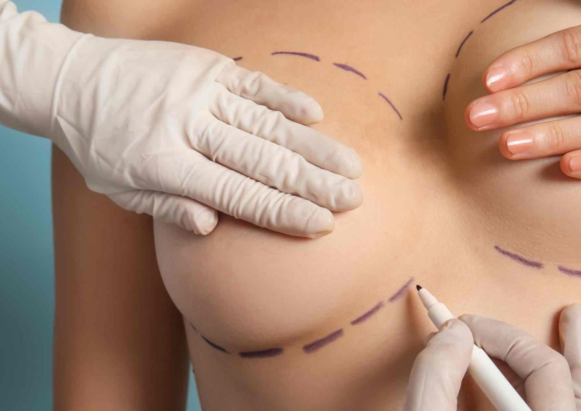 Pall Mall Fallback Image