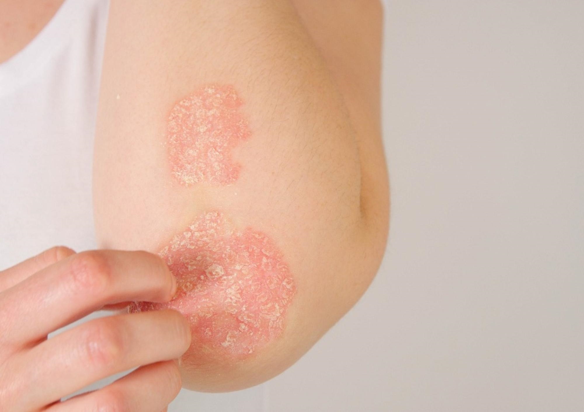 Pall Mall Fallback Image