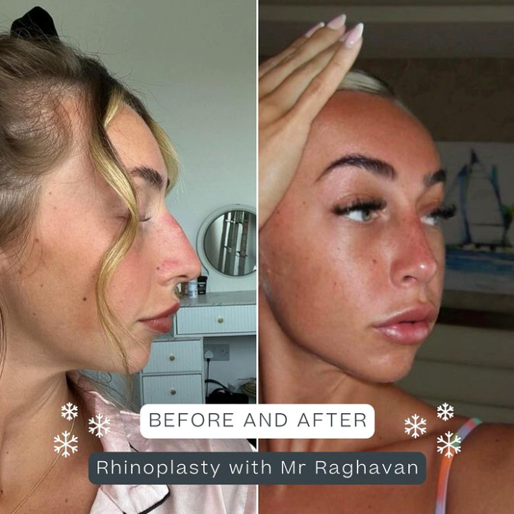 Pall Mall Fallback Image