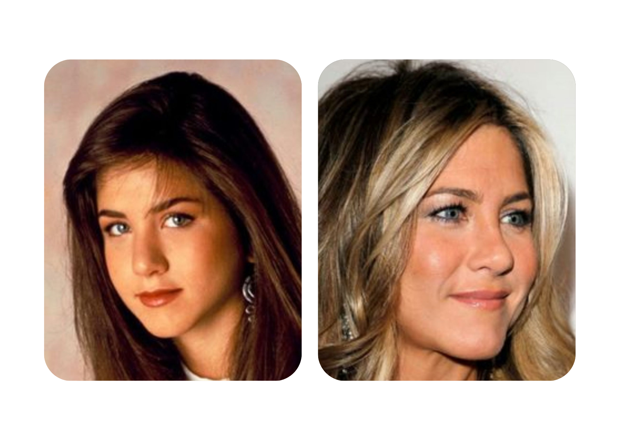 Jennifer Aniston's before and after nose surgery