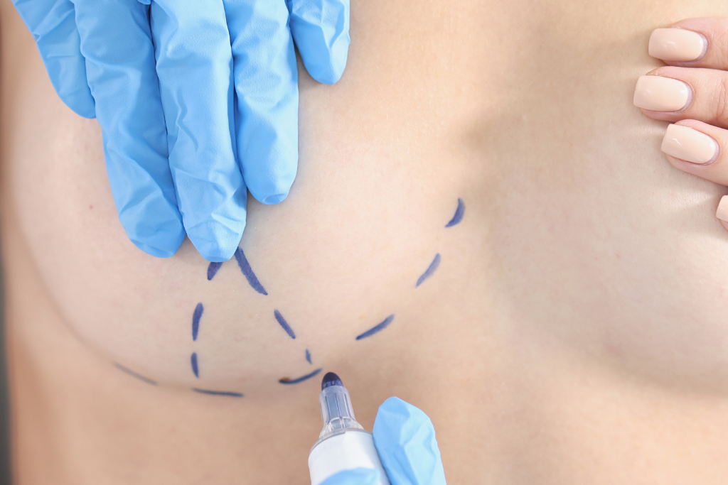 Pall Mall Fallback Image