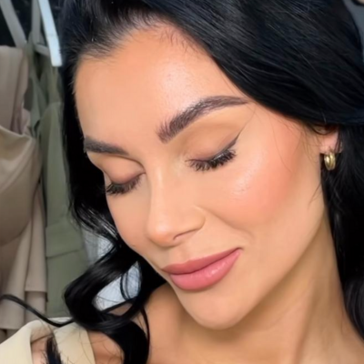 Pall Mall | Cally Beech after Nose Job 