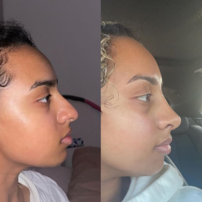 Pall Mall Fallback Image