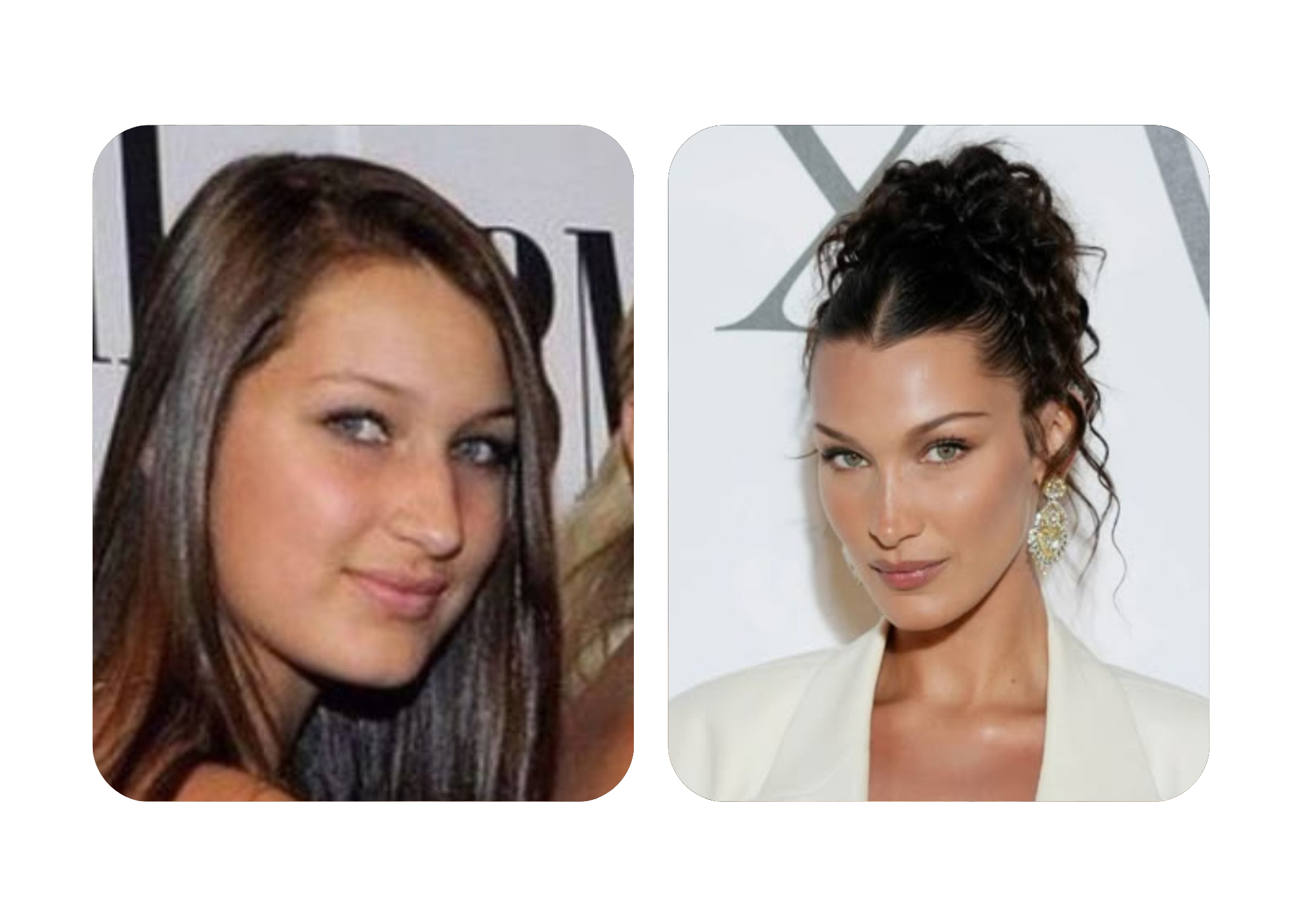 Bella Hadid nose surgery before and afters