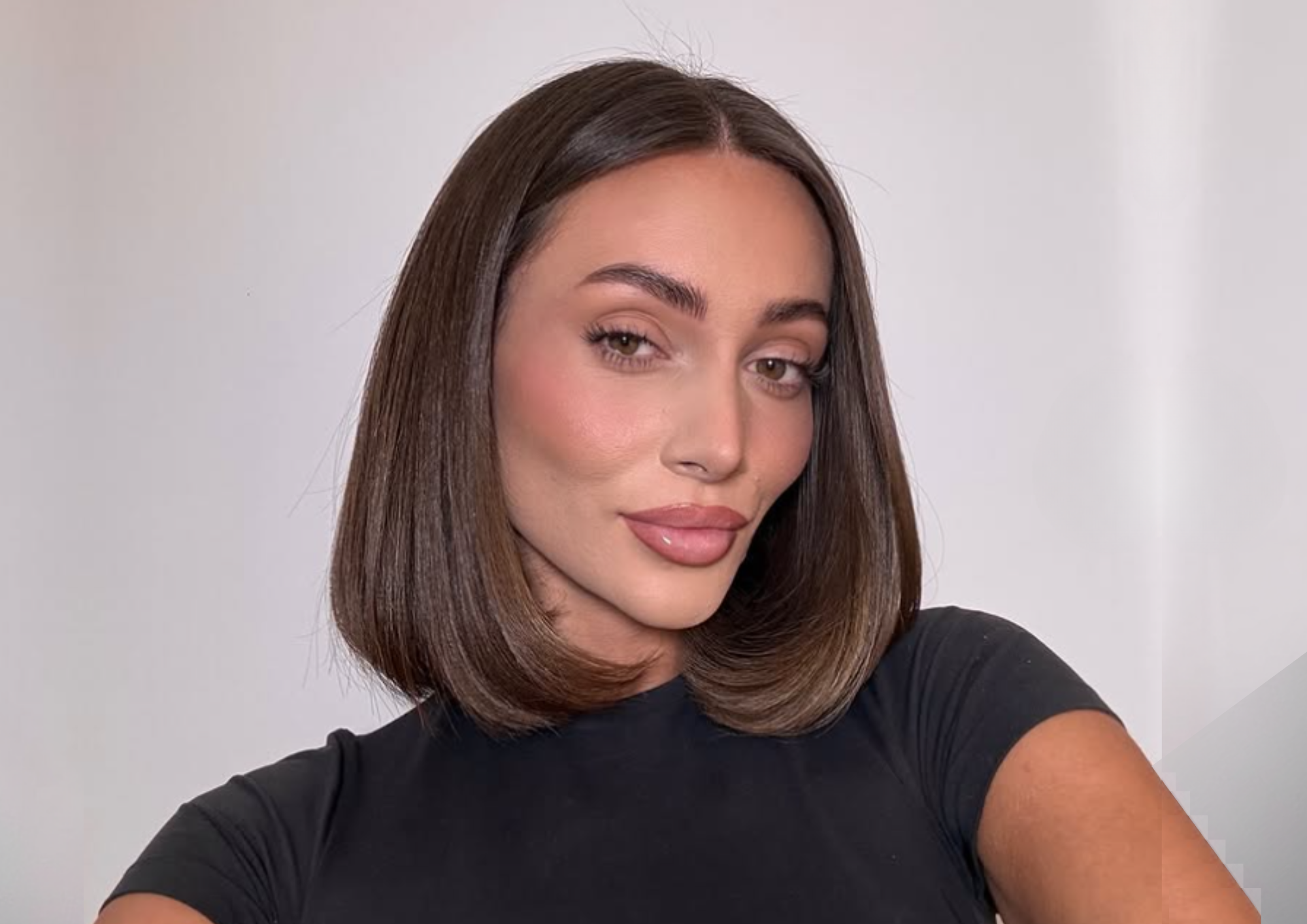 Lydia Fowler Pall Mall Septorhinoplasty pateint