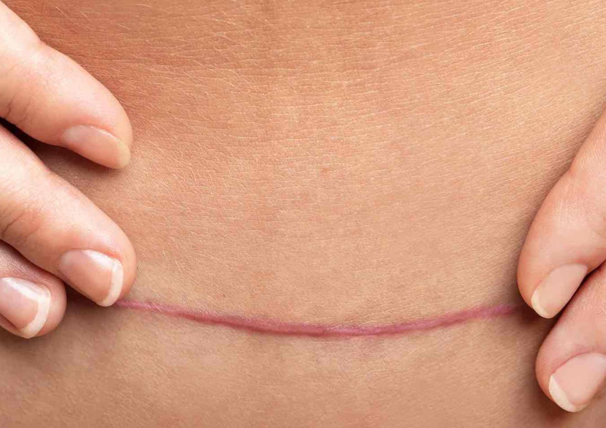 Pall Mall Fallback Image