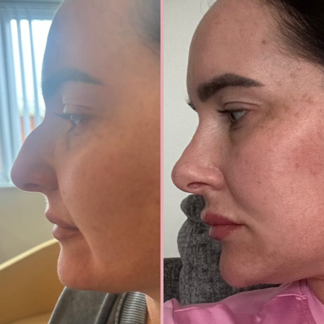 Pall Mall Fallback Image