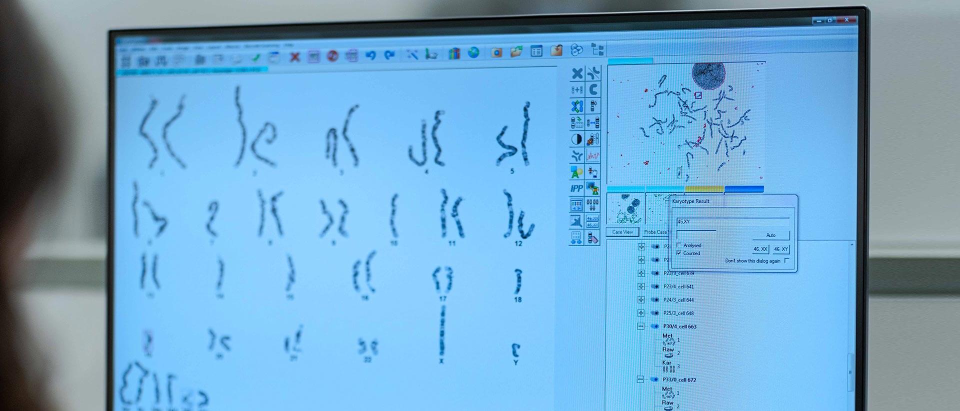 Monitor with a genetic karyotype analysis card