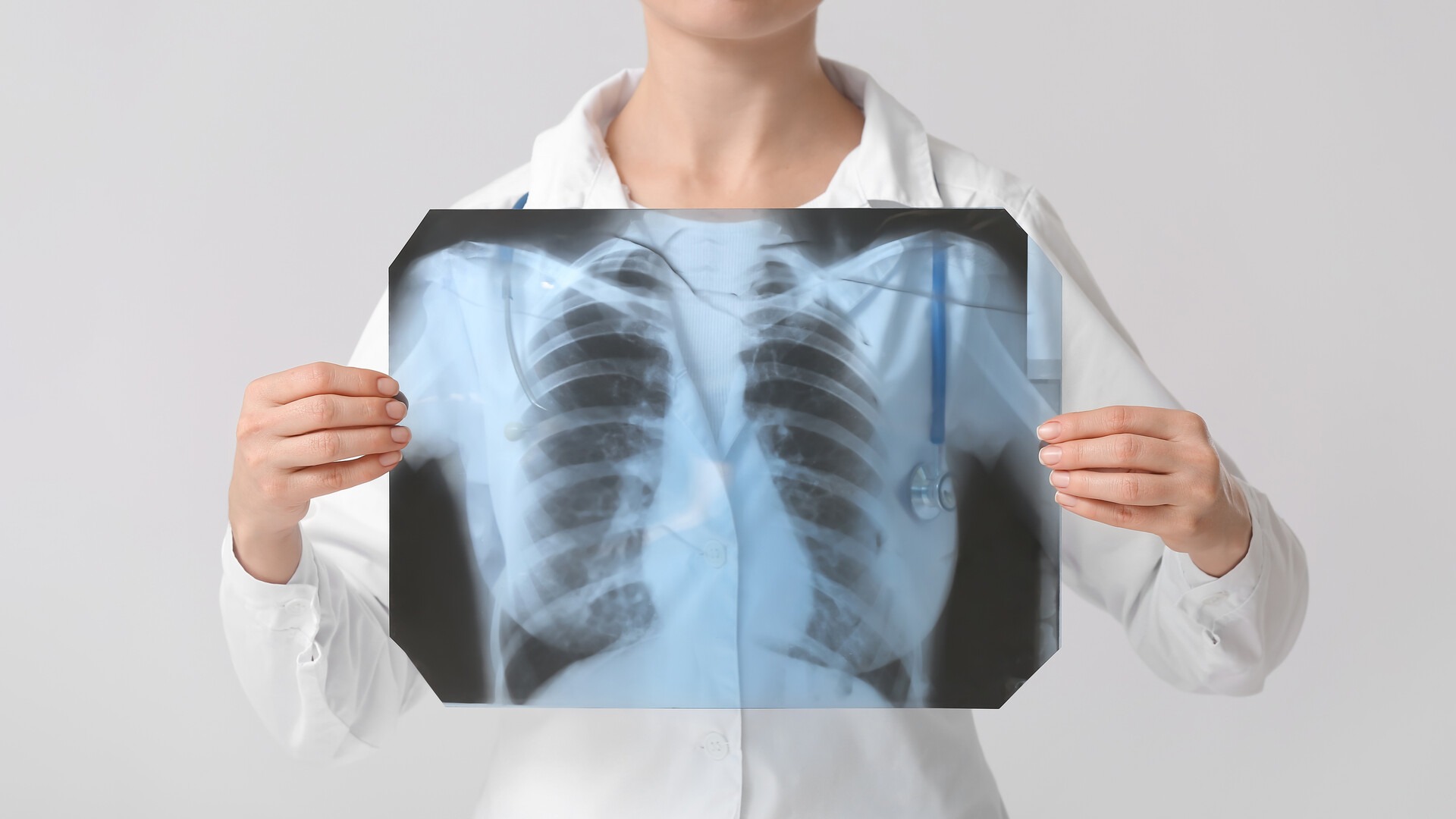 Chronic obstructive pulmonary disease (COPD): what it is, symptoms and treatment 