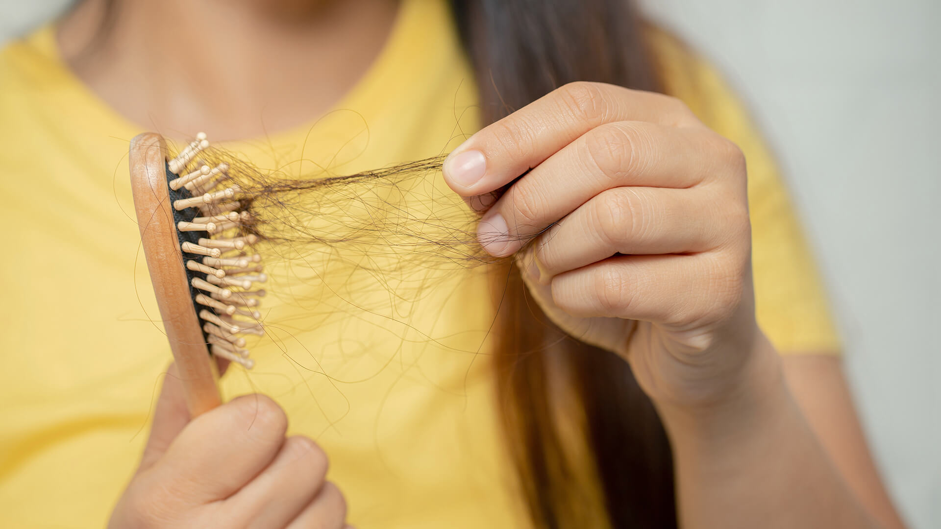 Hair loss: causes, symptoms and treatment