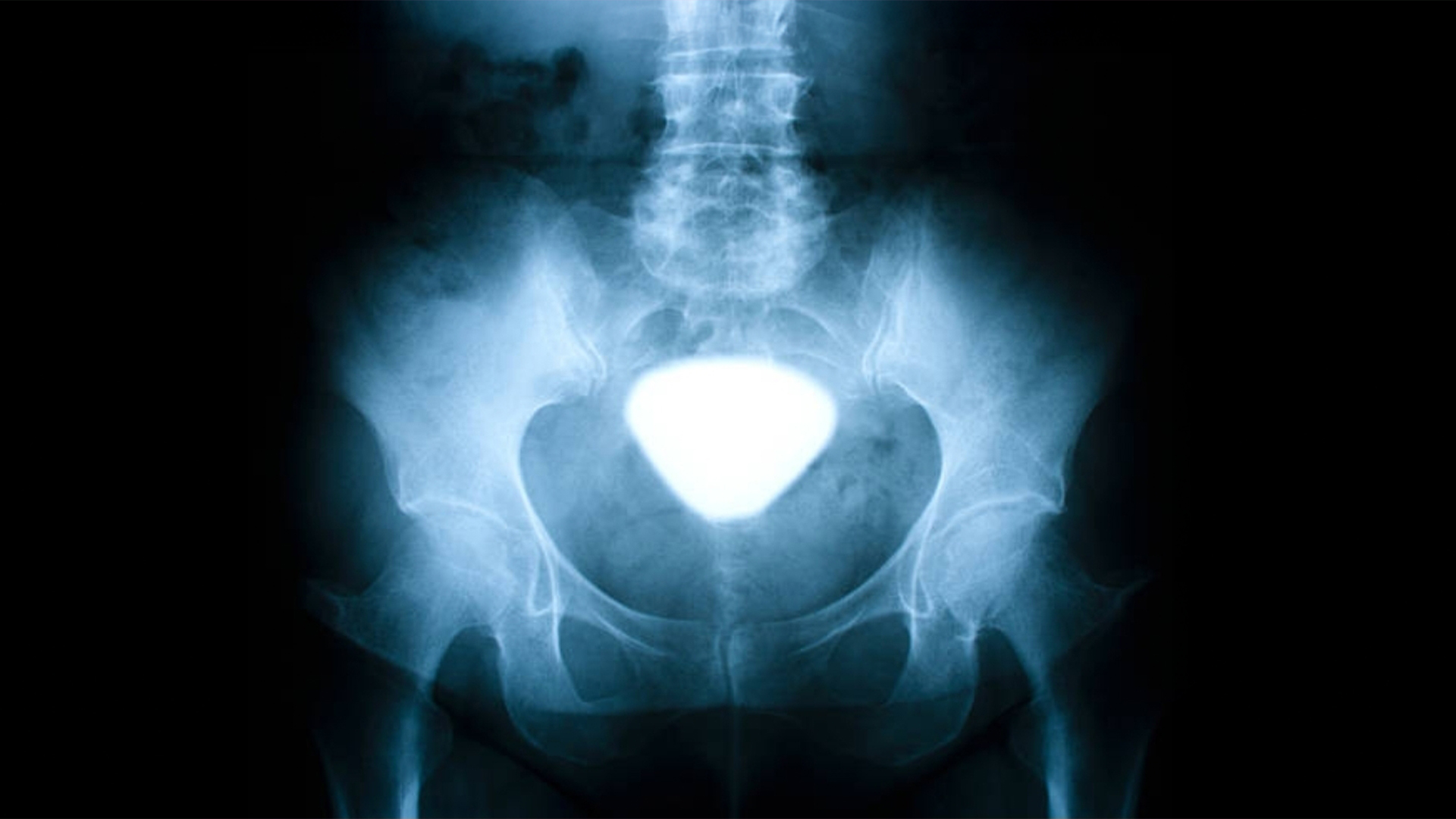 urethrography 