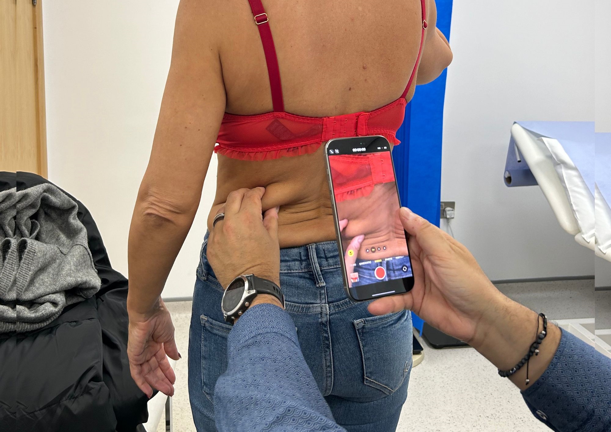 Traditional vs VASER liposuction