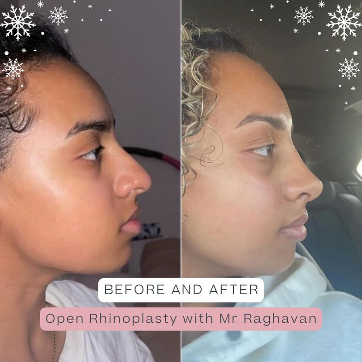 Pall Mall Fallback Image