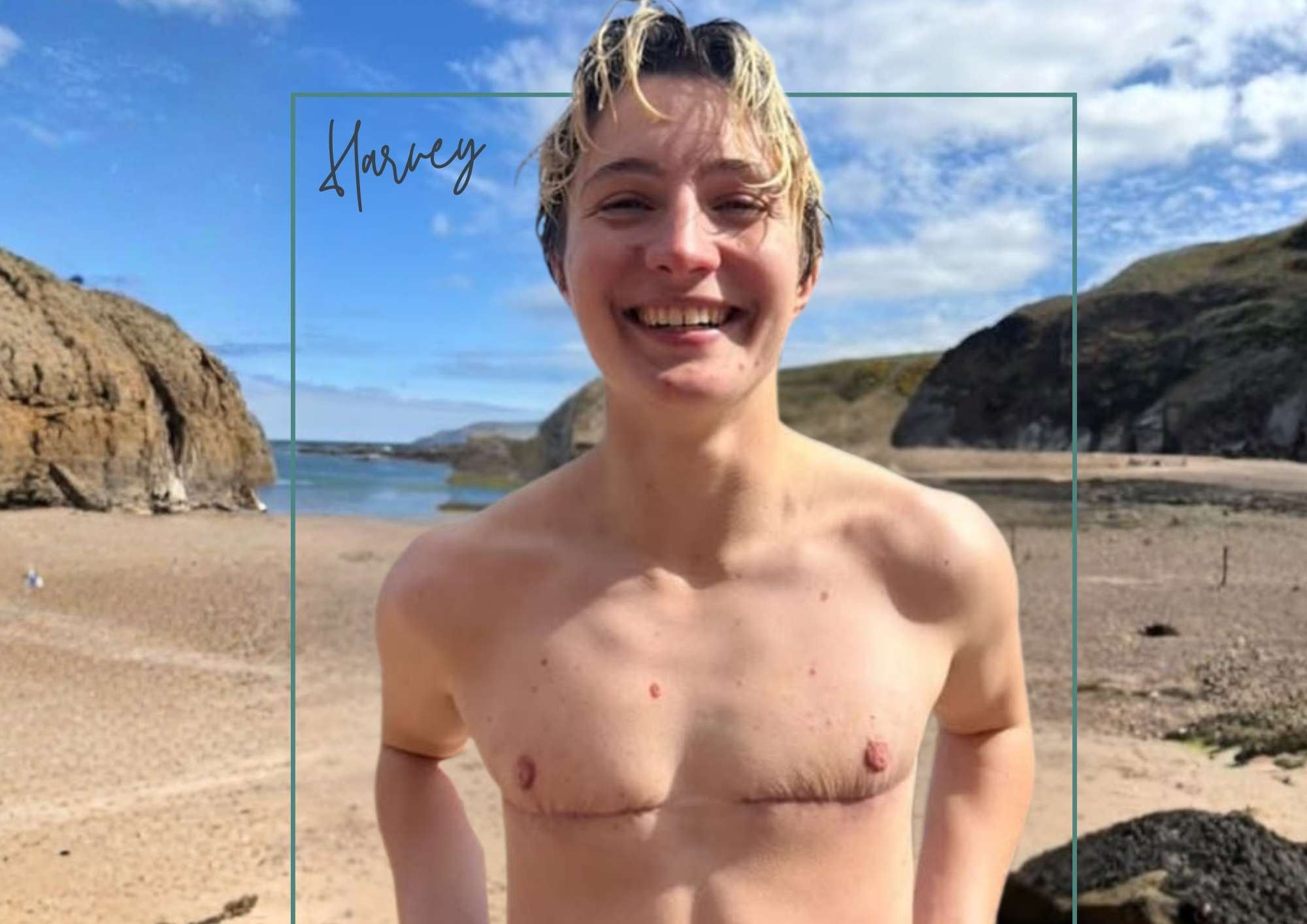 Harvey, Gender Affirmation Patient Harvey, Gender Affirmation Patient