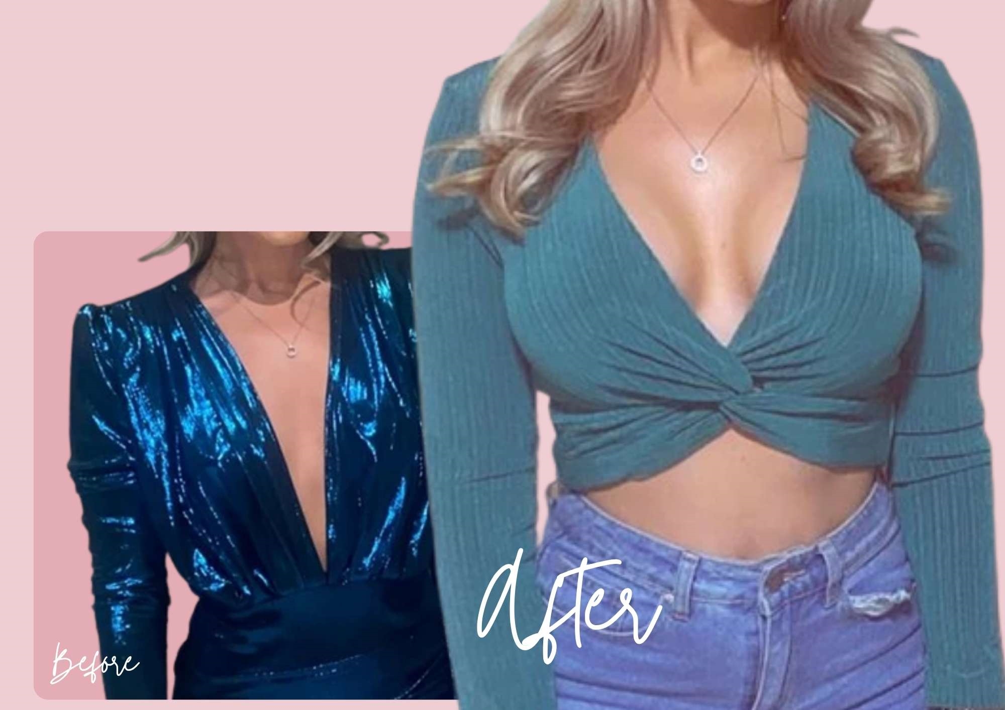 Sarah Powell, Breast enlargement patient's before & after