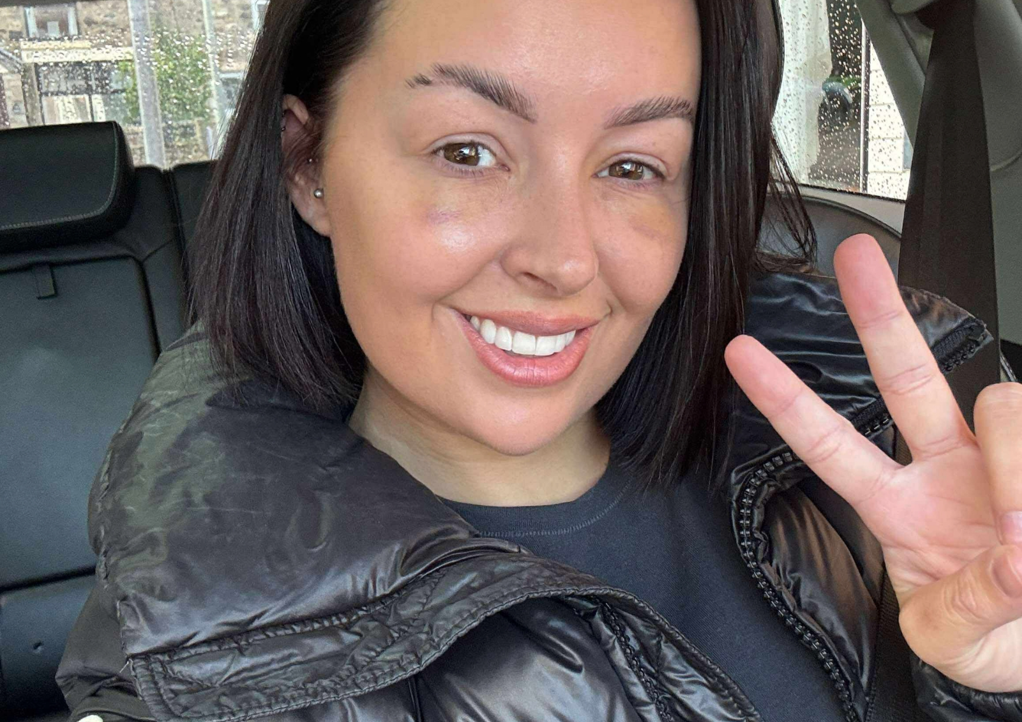 Woman Smiling after Lower Blepharoplasty