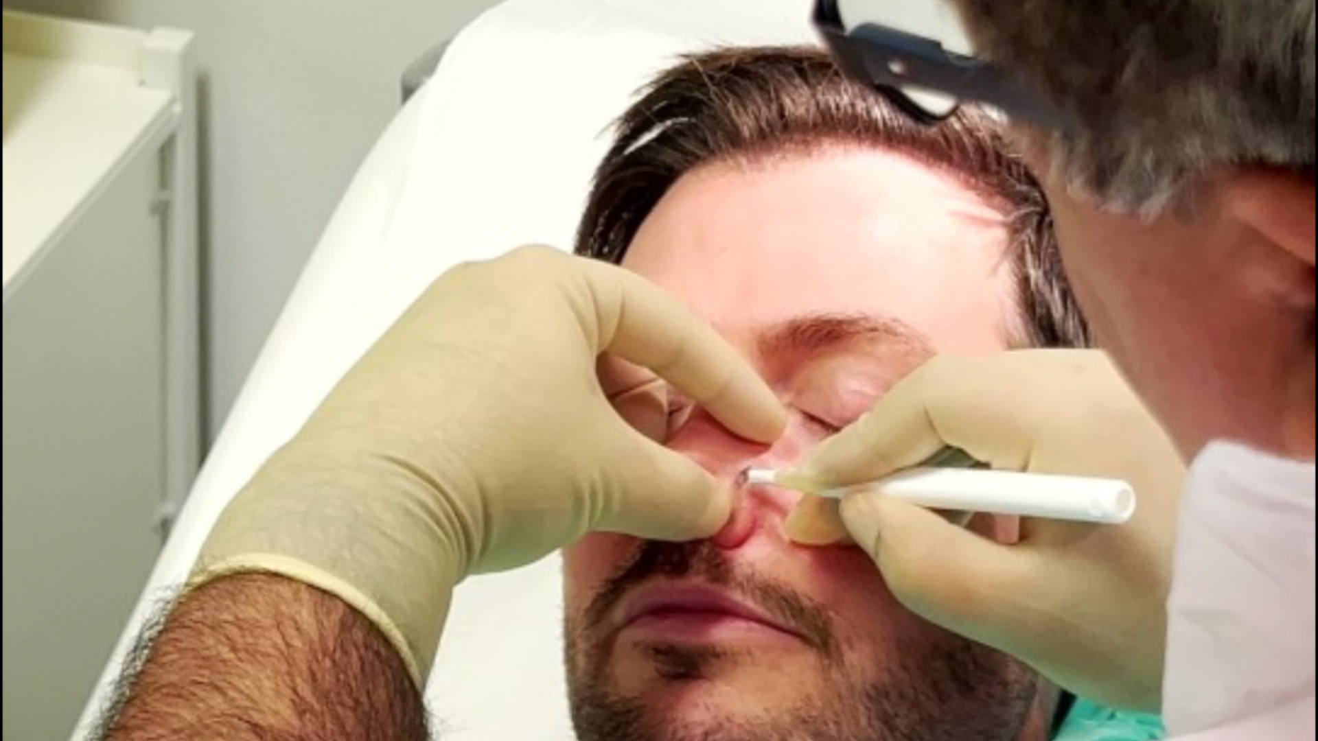 Pall Mall patient having a lesion removed