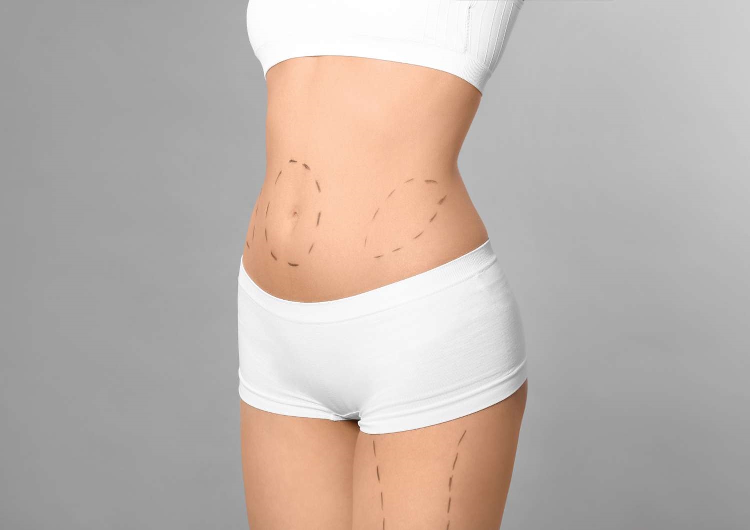 Tummy Tuck Procedures