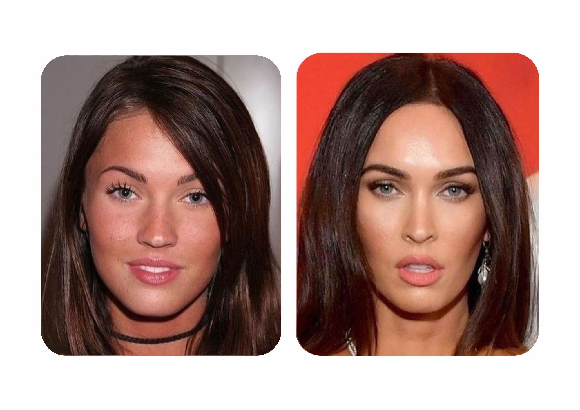 Megan Fox before and after rhinoplasty