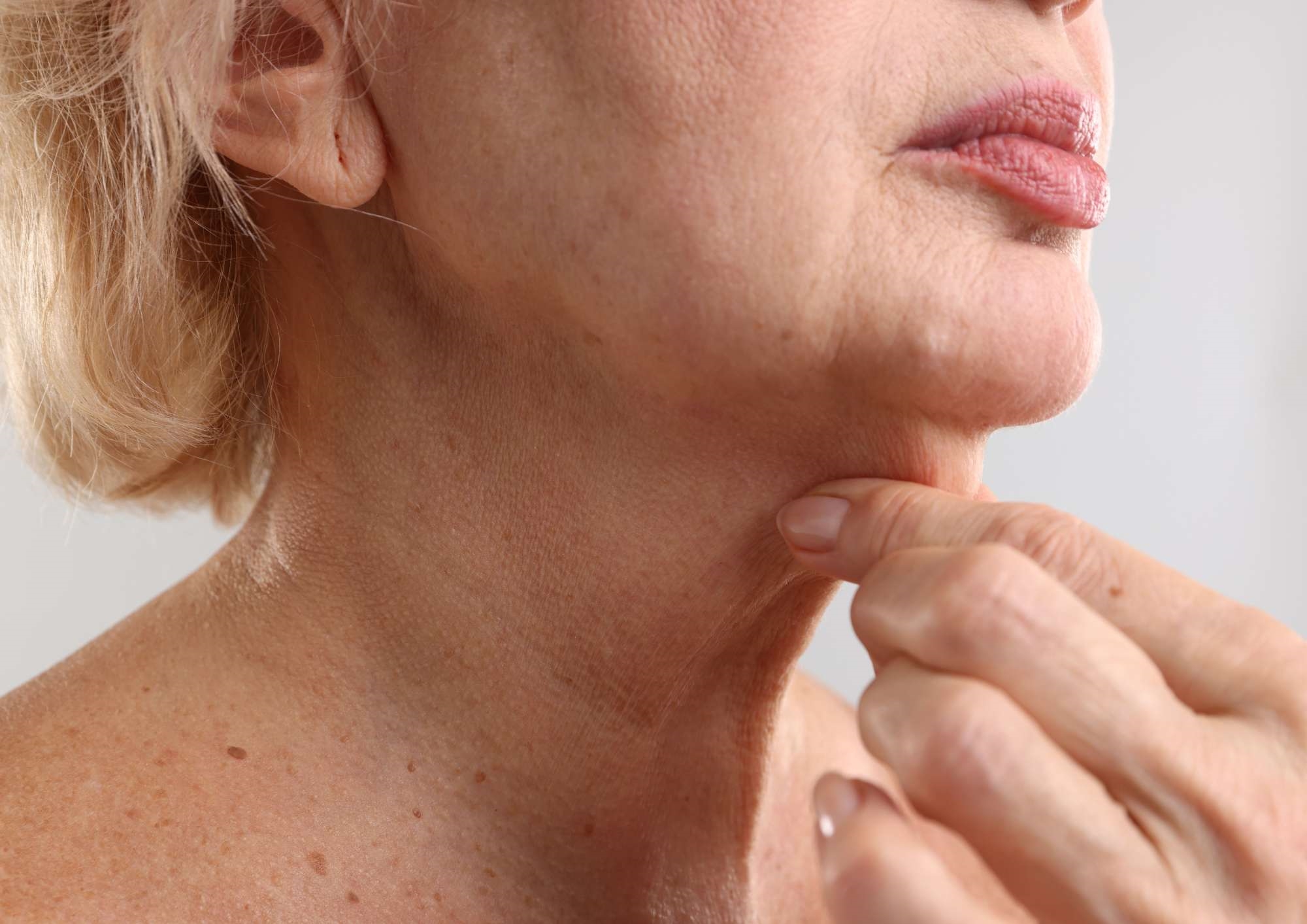Types of neck lift surgery explained
