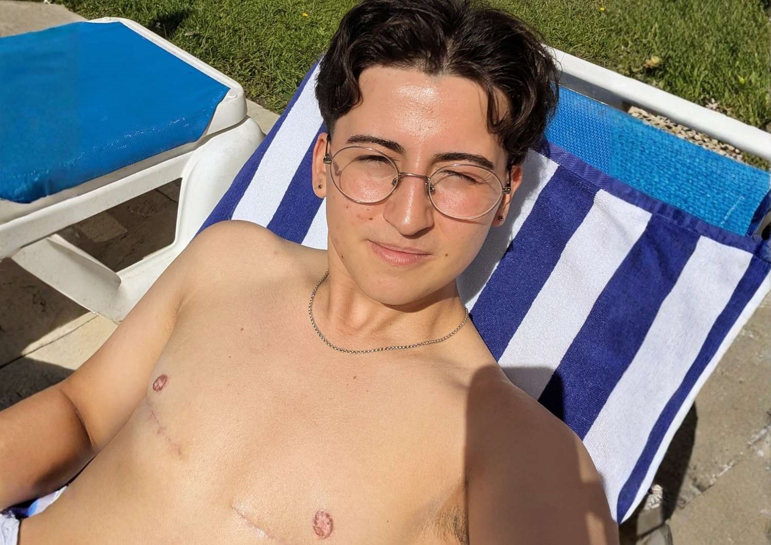 Gender-Affirming Top Surgery (FTM Top Surgery)