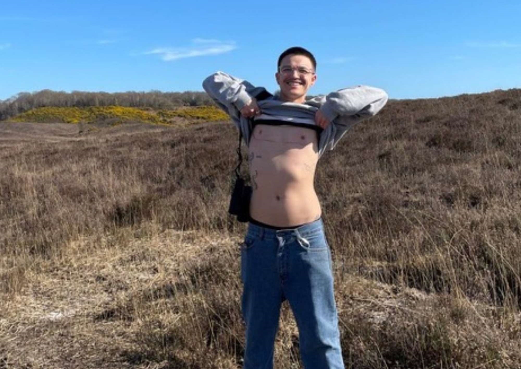 Gender affirmation patient Gender affirmation patient