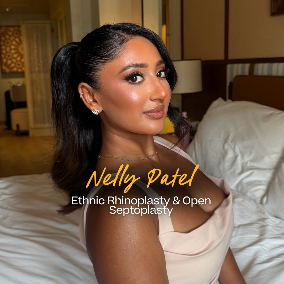 Nelly Patel's Ethnic Rhinoplasty & Open Septoplasty