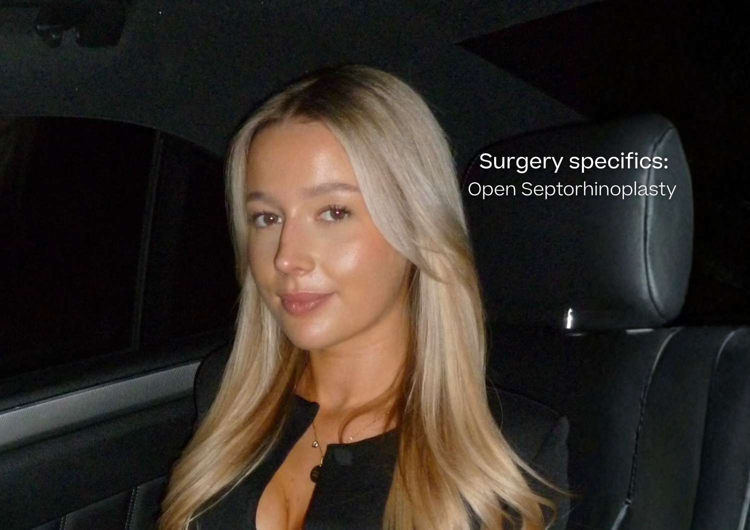 Septorhinoplasty patient