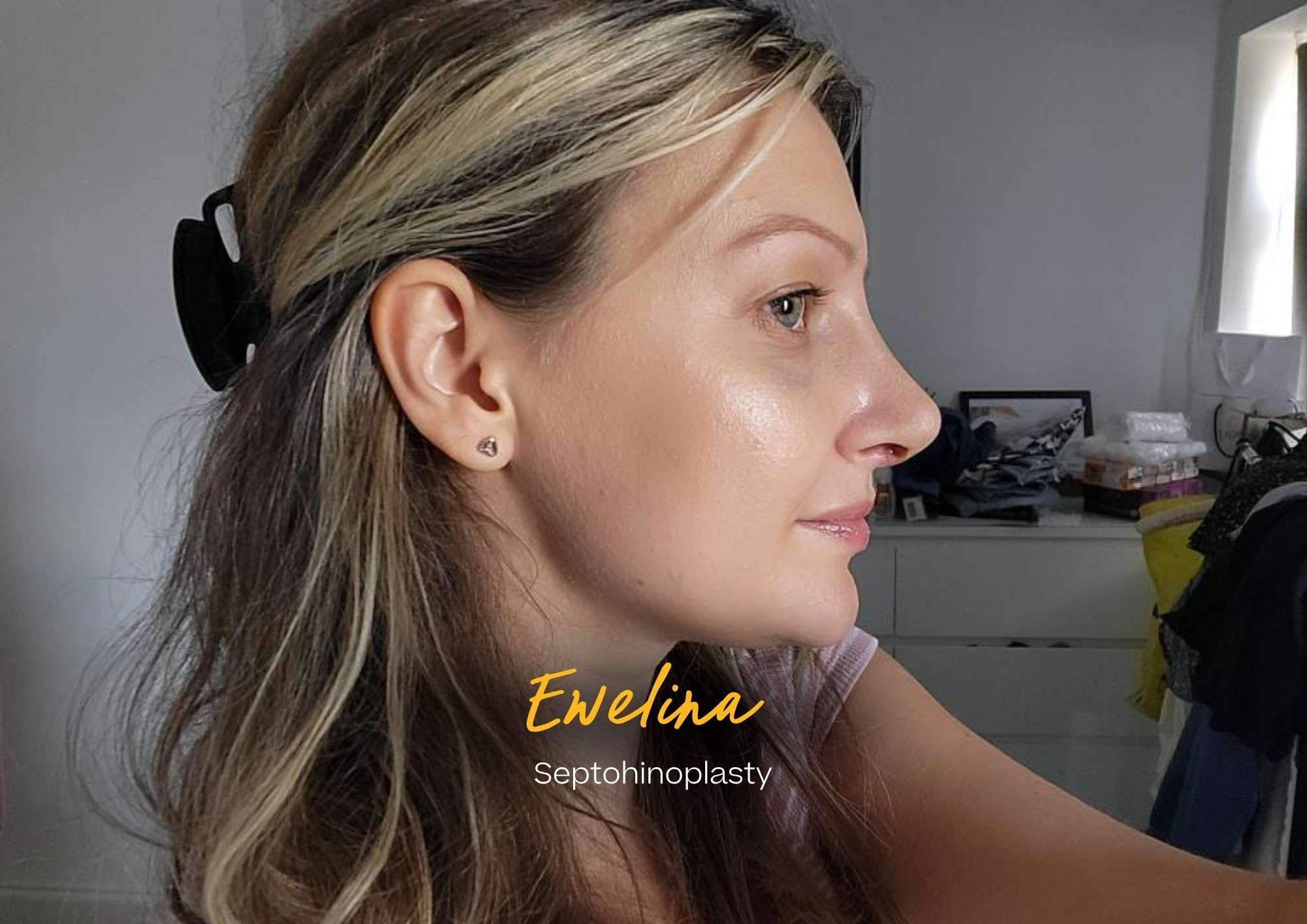 Ewelina’s transformation with Professor Raghavan
