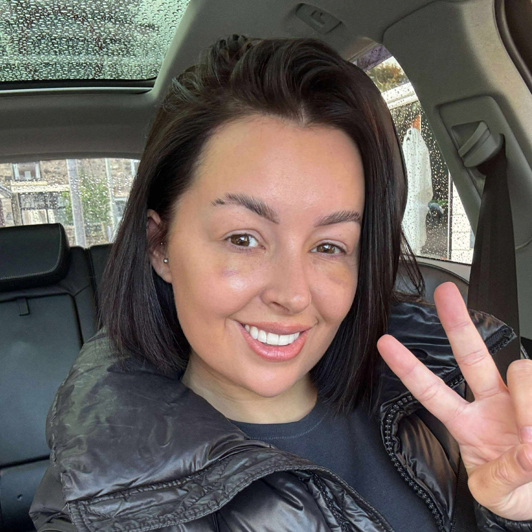 Blepharoplasty Recovery Timeline: What to Expect After Eyelid Surgery