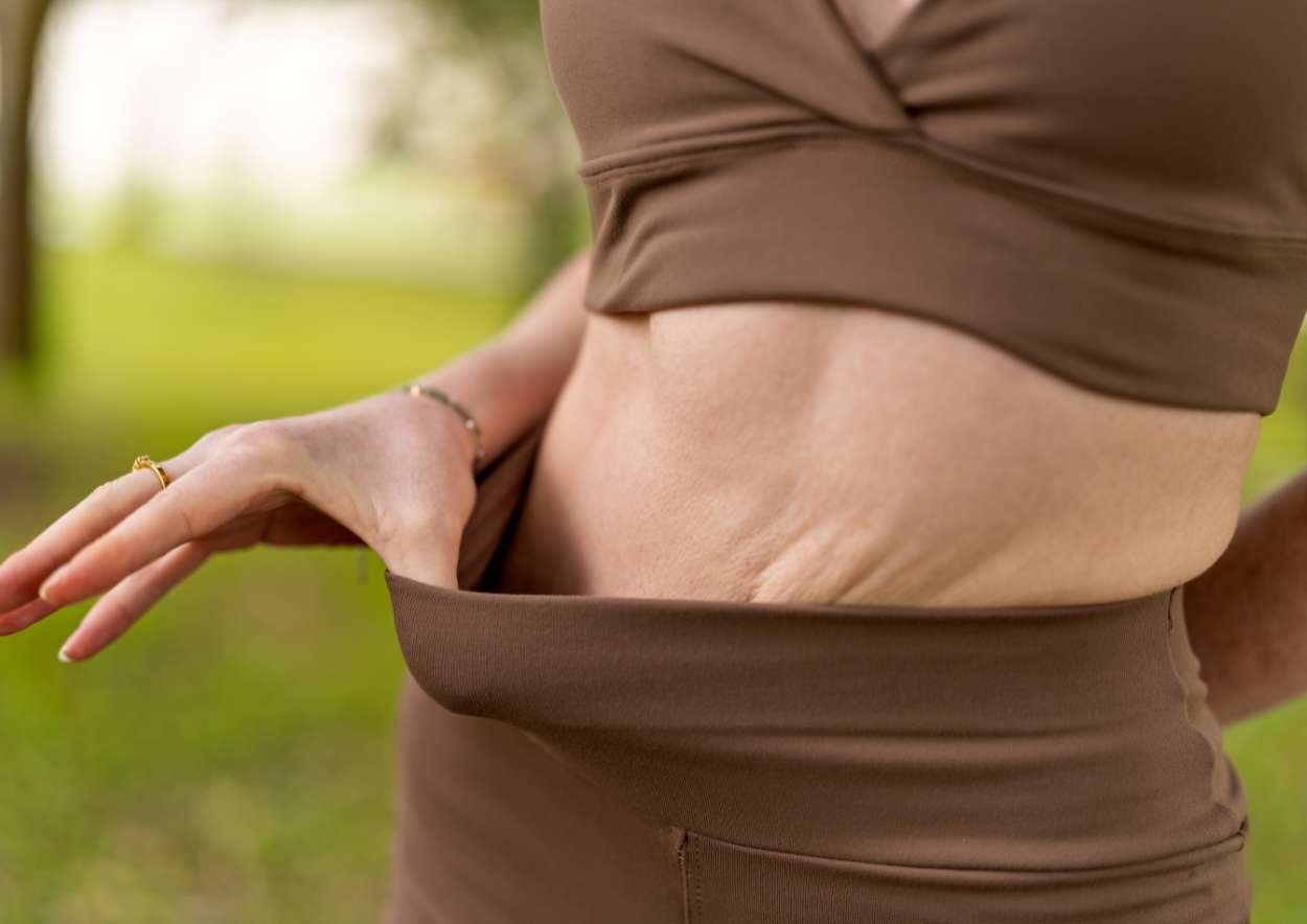 Loose skin? Here are the best procedures after weight loss injections