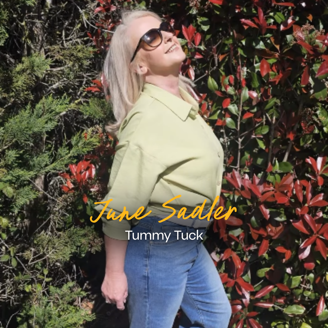 I was a master of disguise: June’s Tummy Tuck Journey