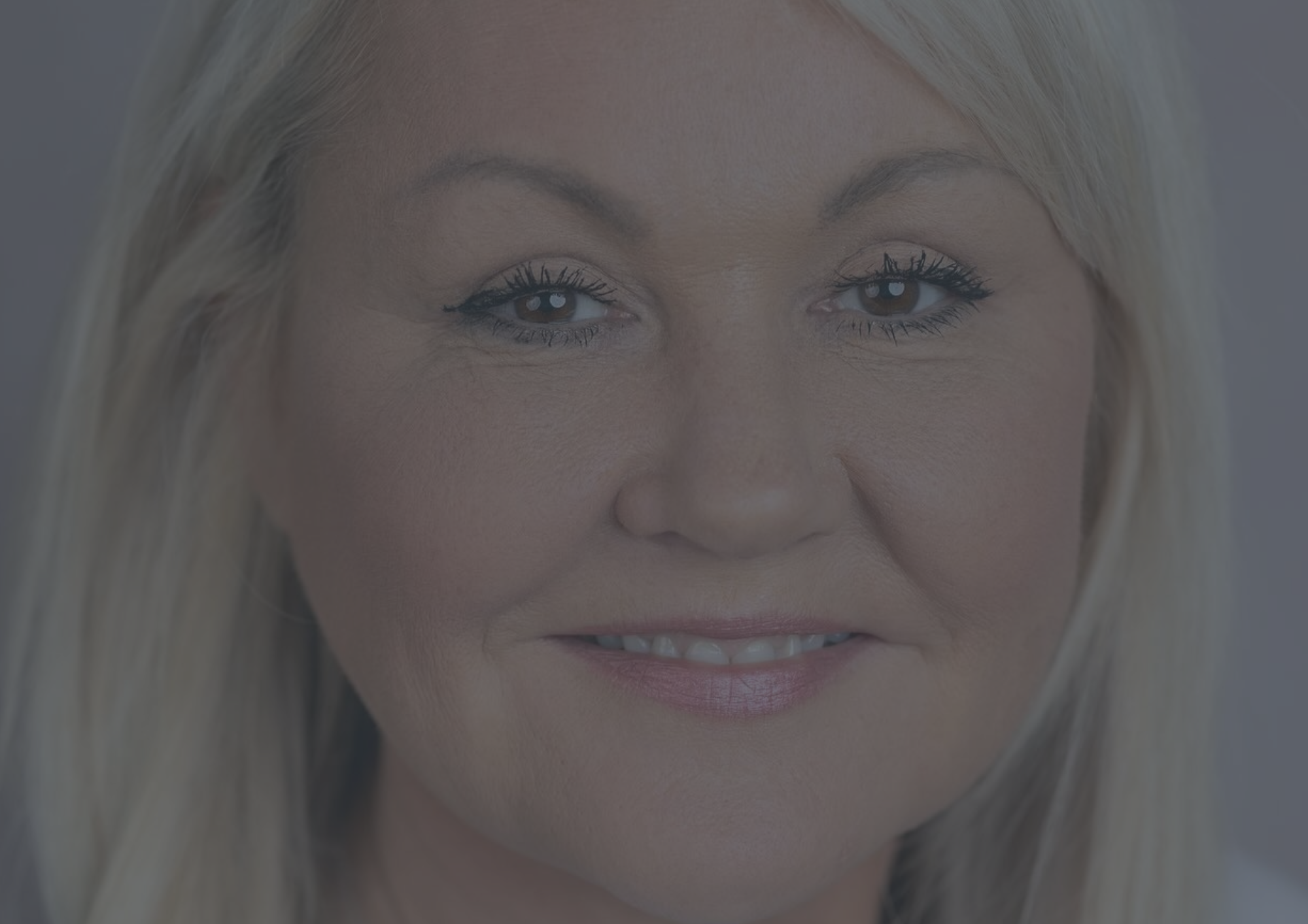 Blepharoplasty Newton-le-Willows Blepharoplasty Newton-le-Willows