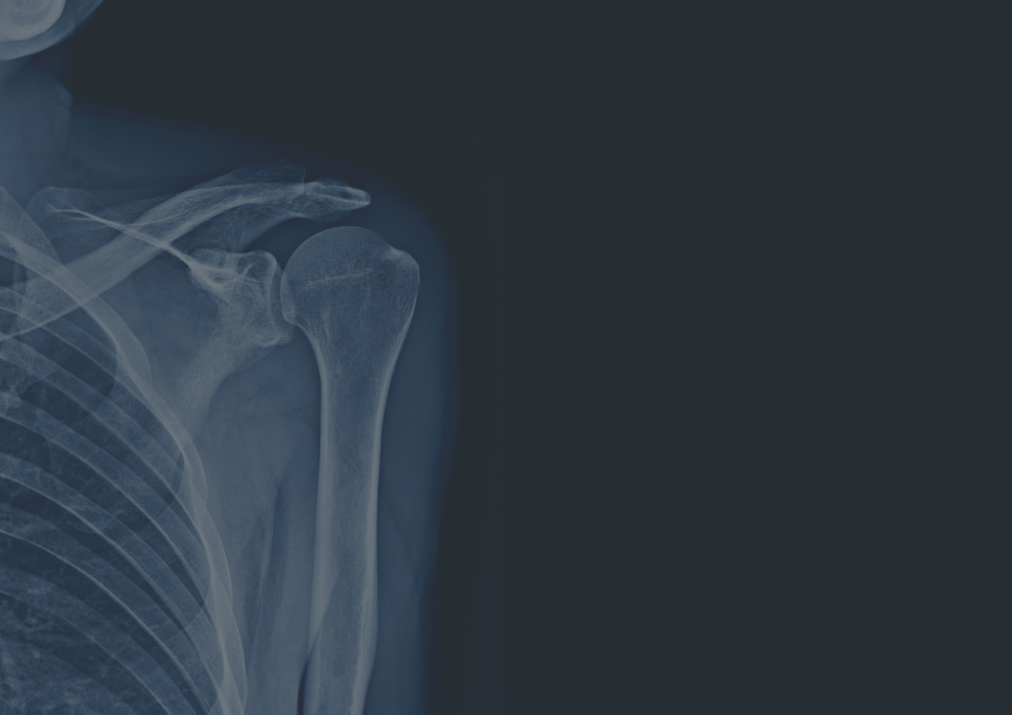 Private x-ray Manchester Private x-ray Manchester