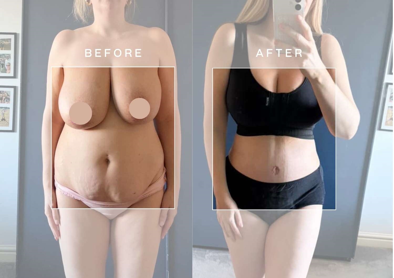 Combining procedure Patient Results