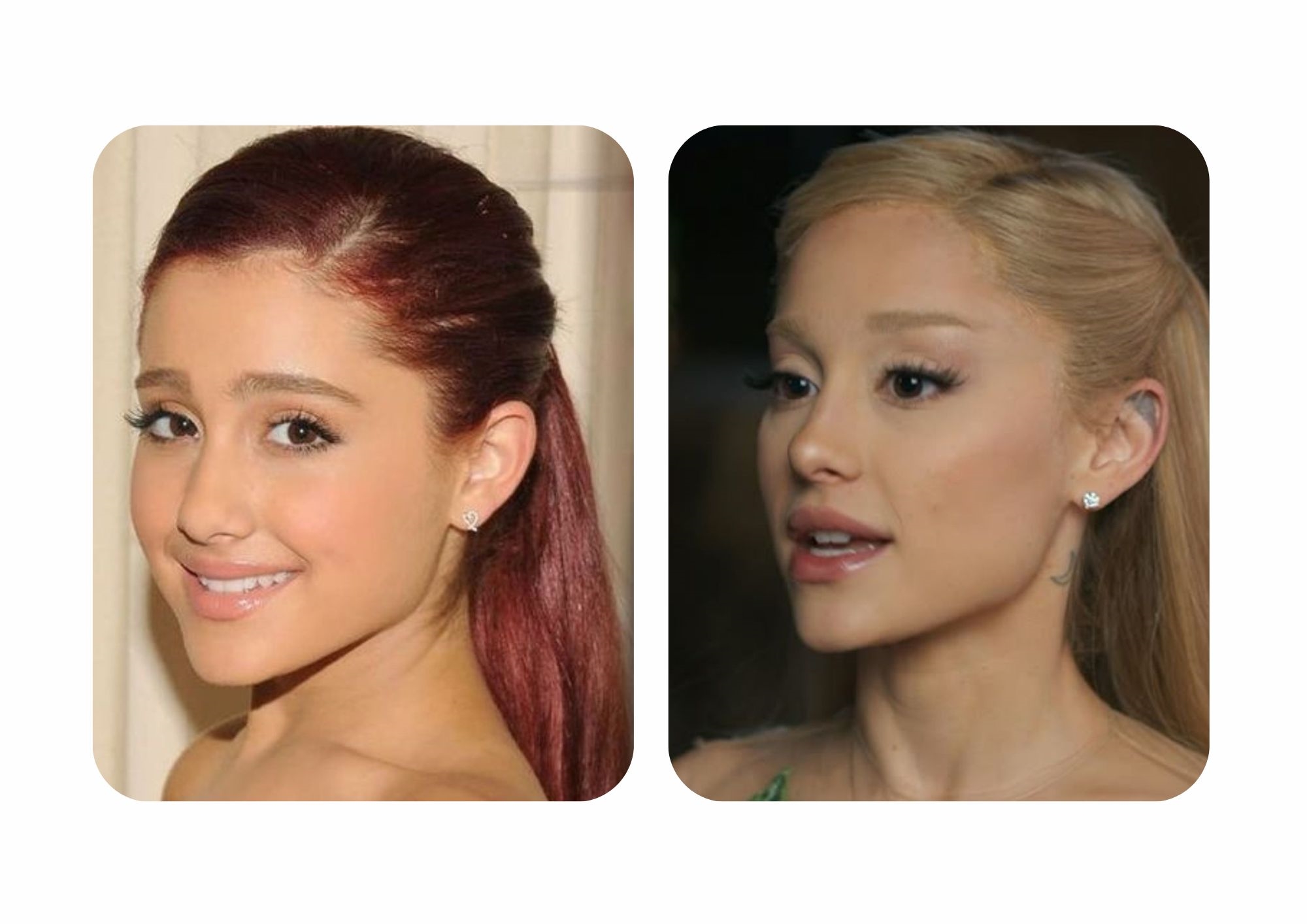 Ariana Grande's before and after nose surgery