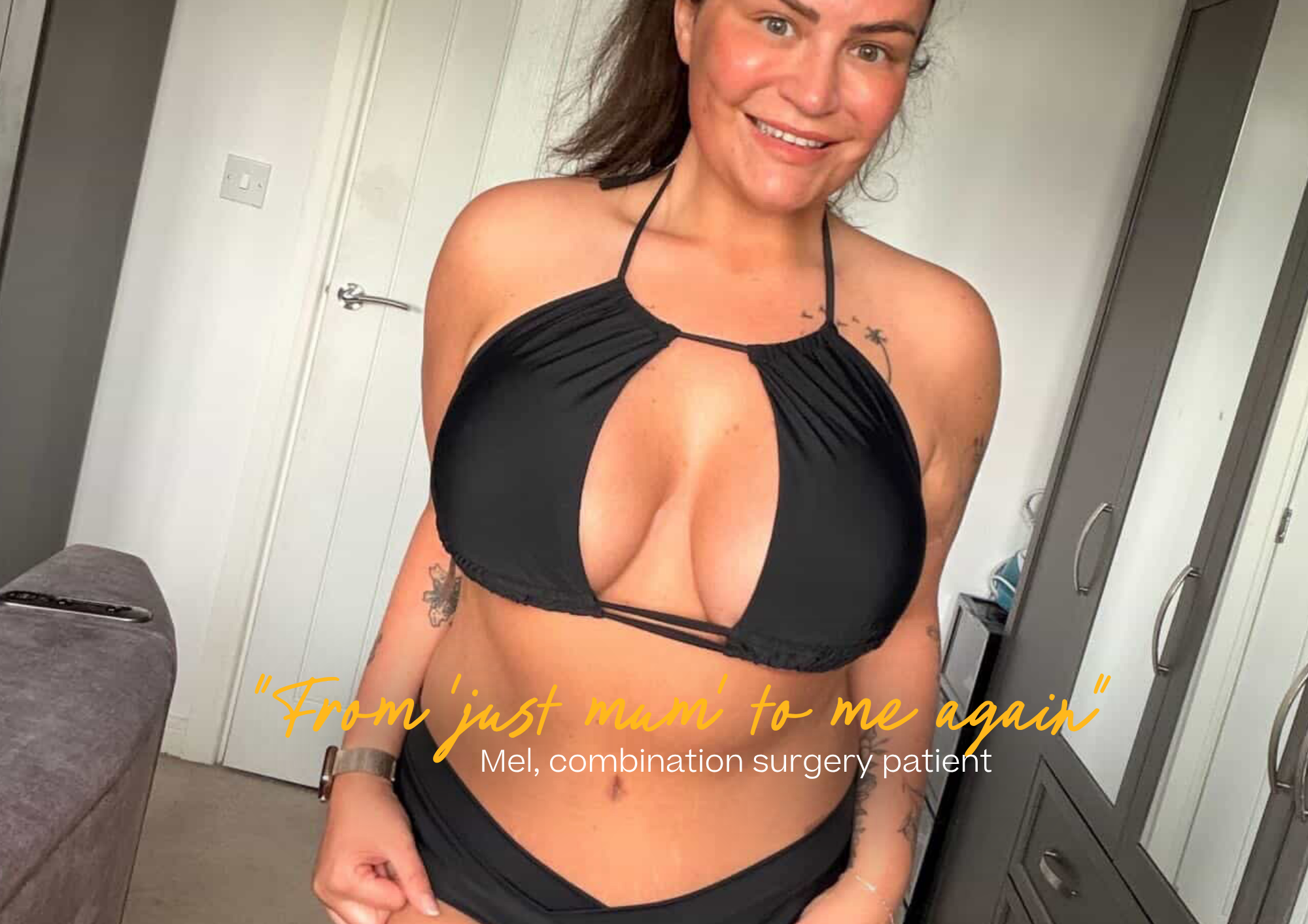 Mel tummy tuck patient