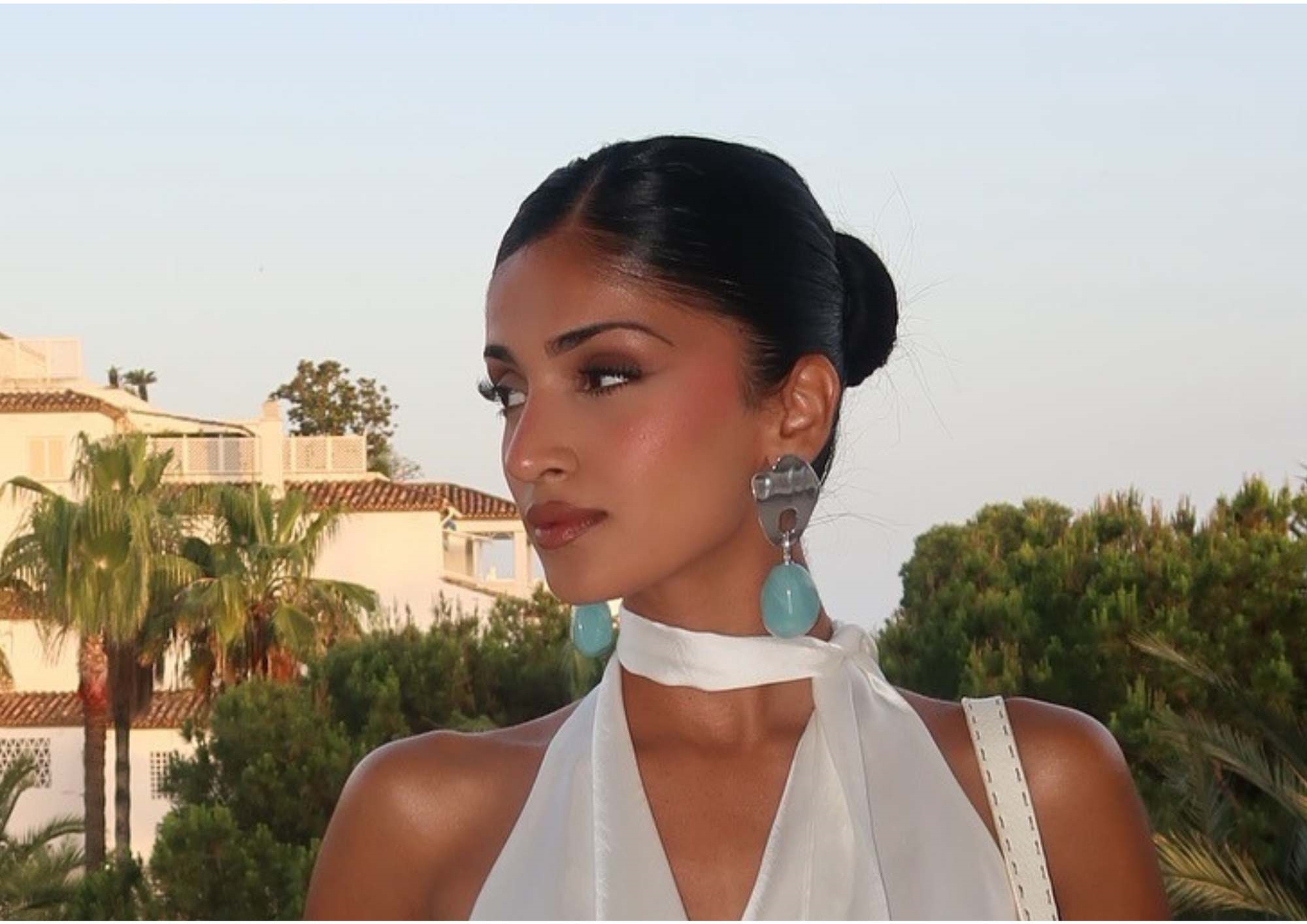 Kim Mann, Rhinoplasty Patient