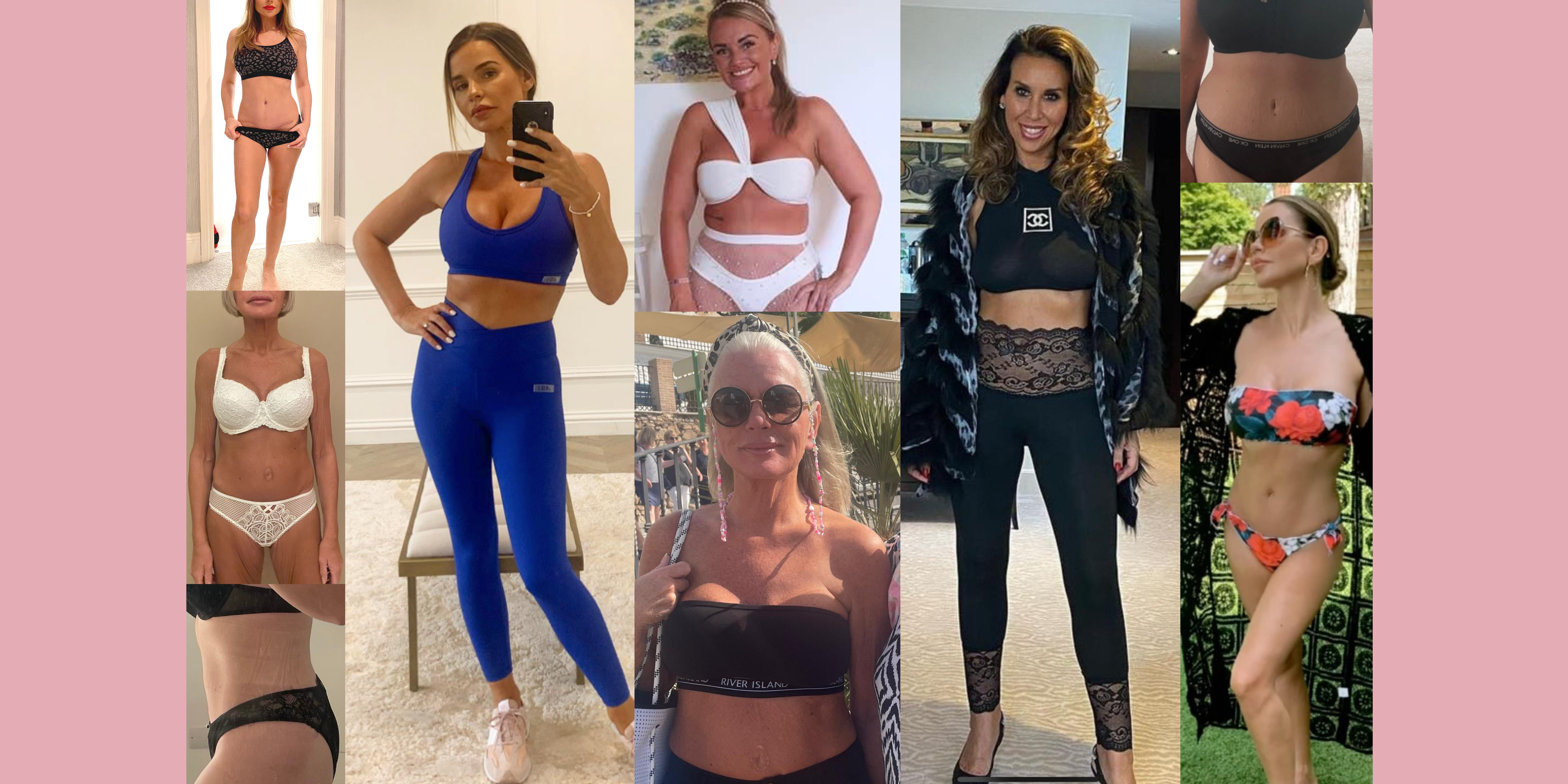 Pall Mall Cosmetics | Tummy Tuck Results