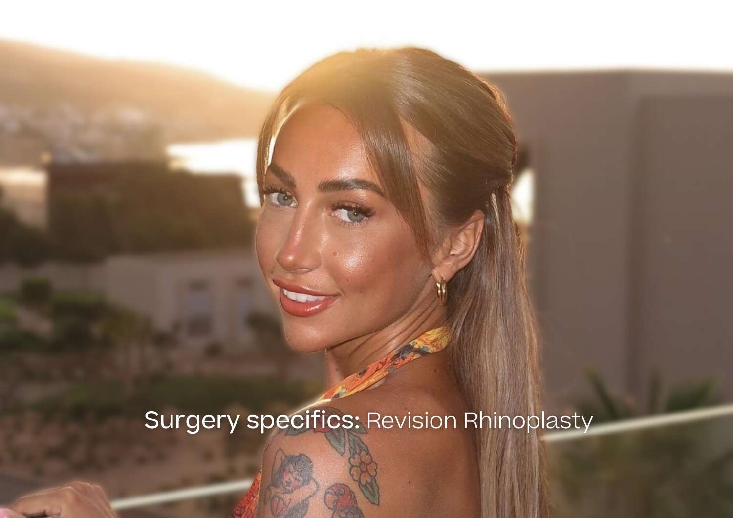 Revision Rhinoplasty Patient